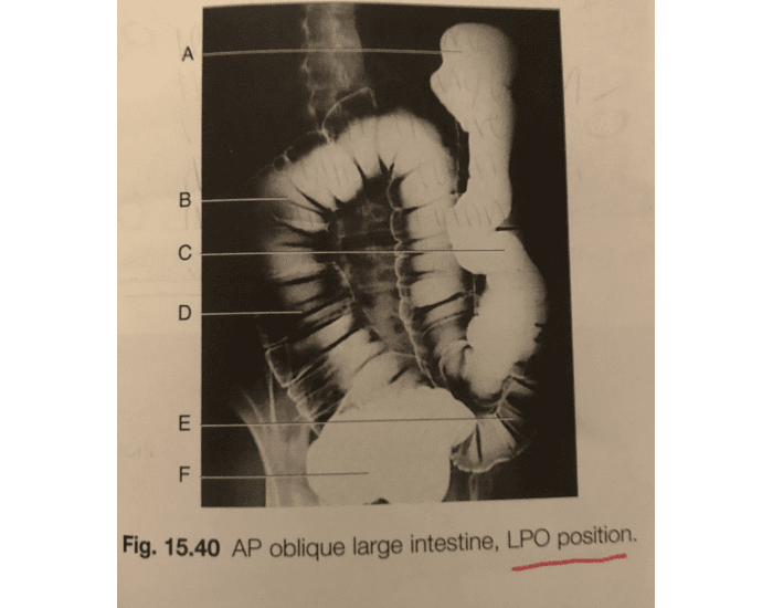 AP oblique large intestine, LPO position Quiz