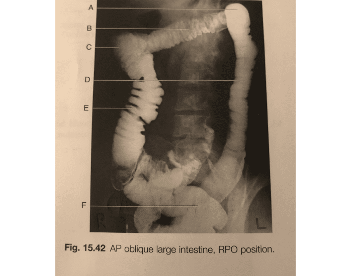AP oblique large intestine, RPO position — Printable Worksheet