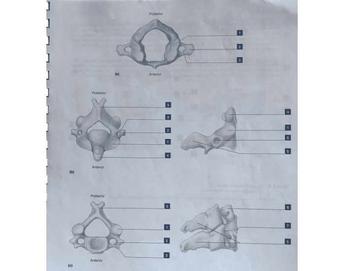 Anatomy Cervical Vertebrae Printable Worksheet