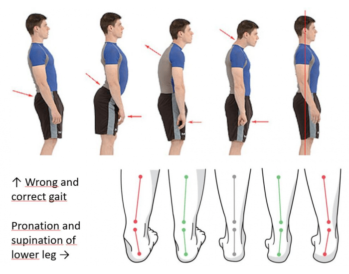 Gait and Lower Leg pronation/supination Quiz