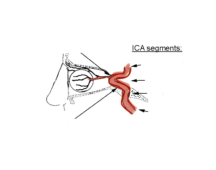 Ica Angulation Intracranial ICA Anatomy — Printable Worksheet