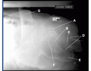 AP oblique rib (LPO) Quiz