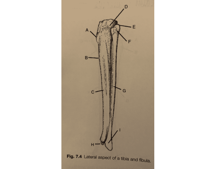 lateral aspect of a tibia and fibula Quiz