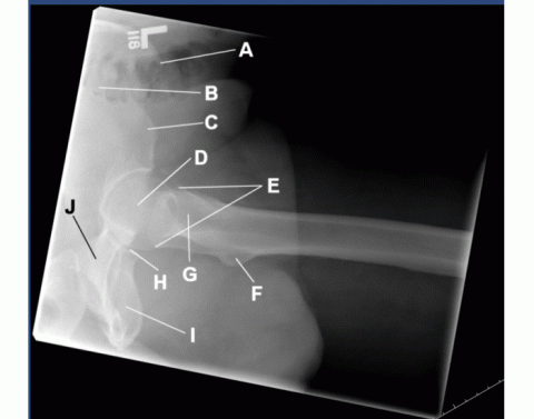 Frog Lateral Modified AP oblique- modified cleaves (frog leg) Quiz