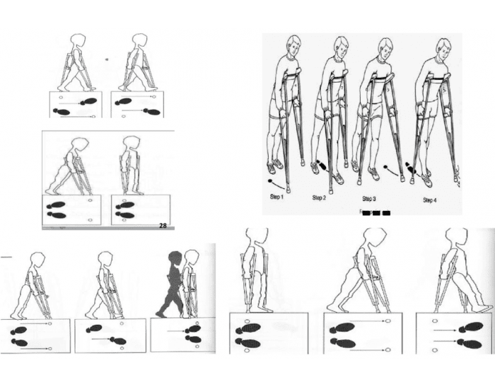 Gait Patterns with Crutches Quiz