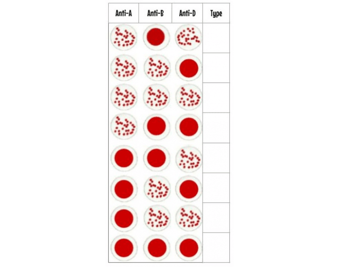 Blood Typing Card Results — Printable Worksheet