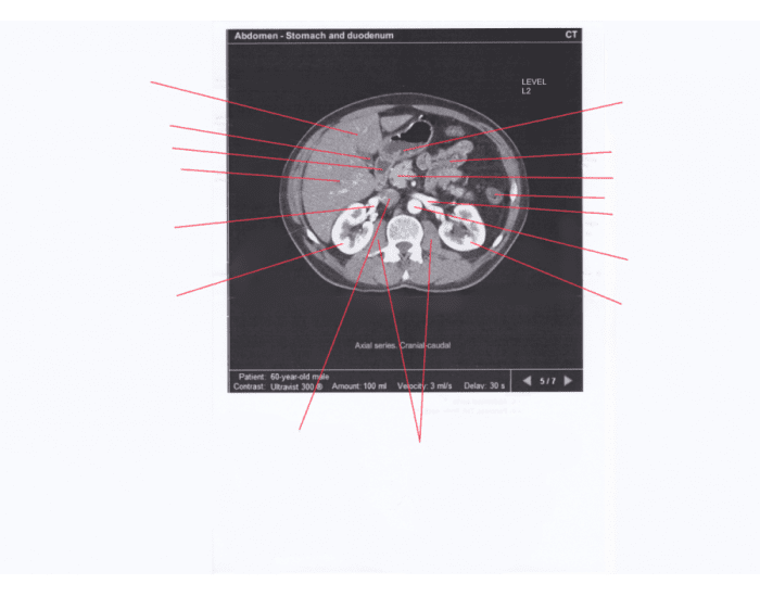 Mri Labelling Pages Labelling MRI of Abdomen 2 Quiz