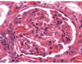 Glomerulus Histology