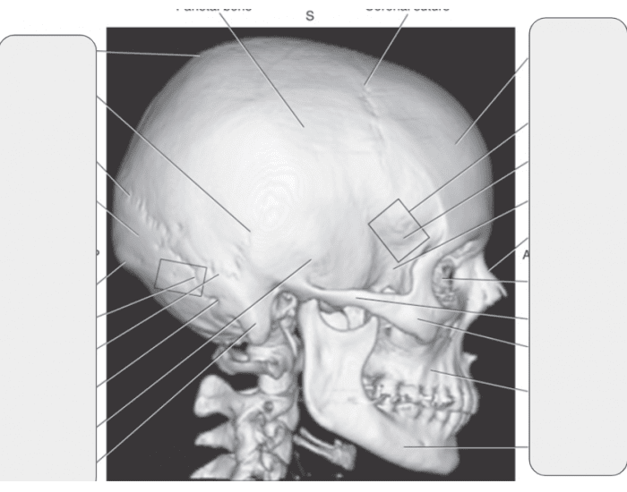 Skull Quiz