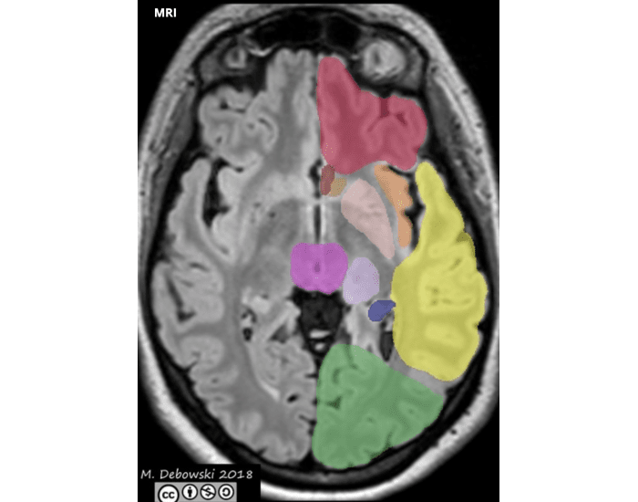 Mri Number MRI identification โ Printable Worksheet