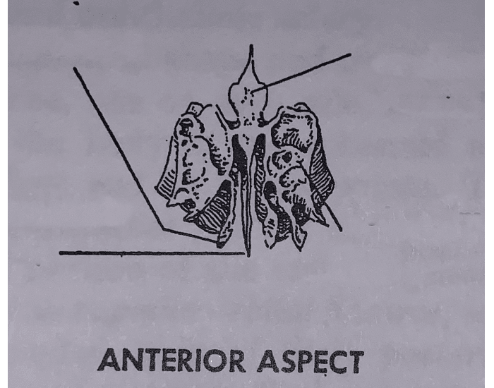 Ethmoid Bone Anterior Aspect Printable Worksheet