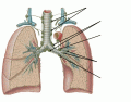 CHA B2: Pulmonary Lymphatics