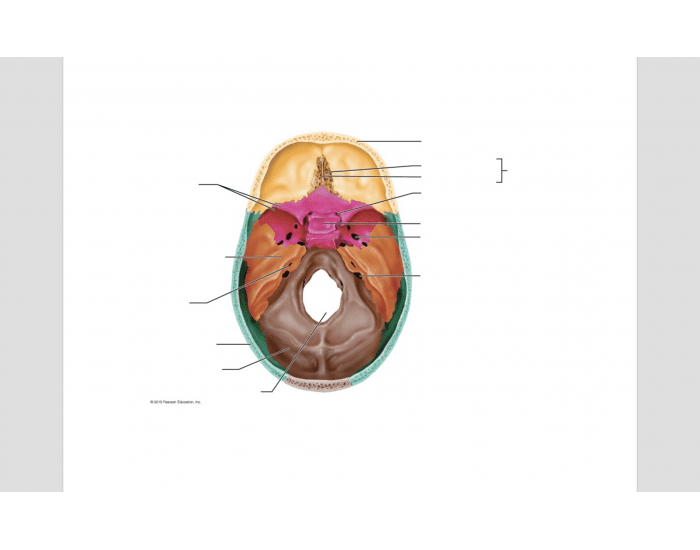 Superior View Of The Skull Calvaria Removed Medical A 6516