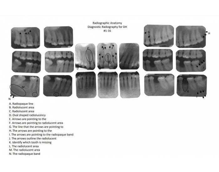 FMS 1 Radiographic Anatomy Quiz