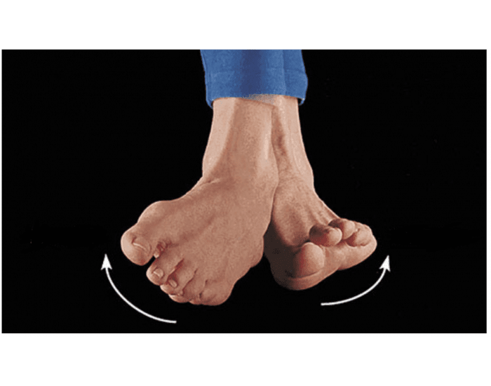 Foot rotation Quiz