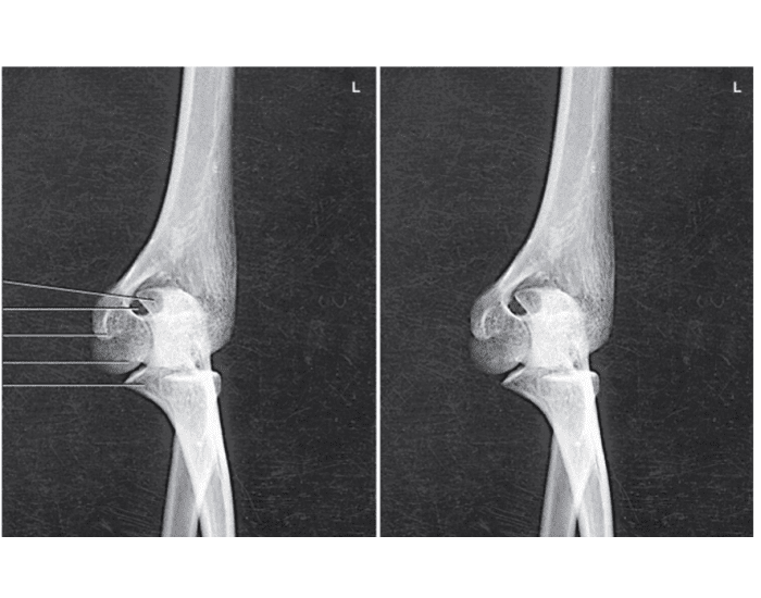 AP Elbow Medial Rotation Quiz