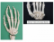 Hand and Carpal Anatomy