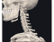 Bones of the cervical spine 