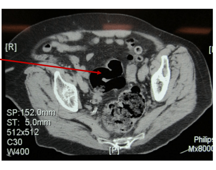Digestive Ct Scan Digestive CT Scan 3 Quiz