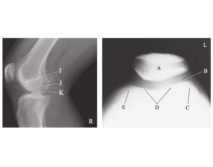 Tangential Projection Radiograph Lateral & Tangential Projection knee Quiz