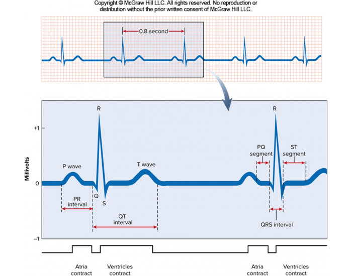 Electrocardiograph Quiz