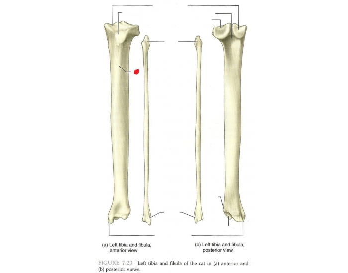tibia and fibula Quiz