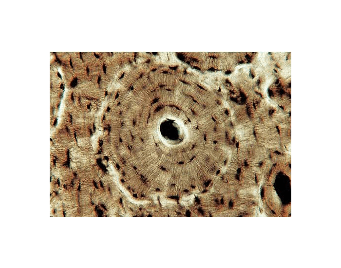 Compact Bone Quiz