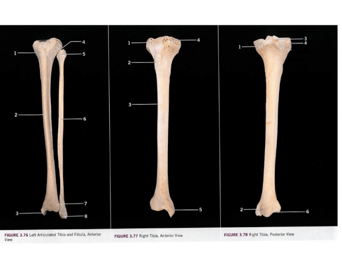 Tibia Fibia Printable Tibia Fibula (anterior posterior view) — Printable Worksheet