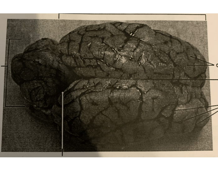 anatomy sheeps brain lab practical Quiz