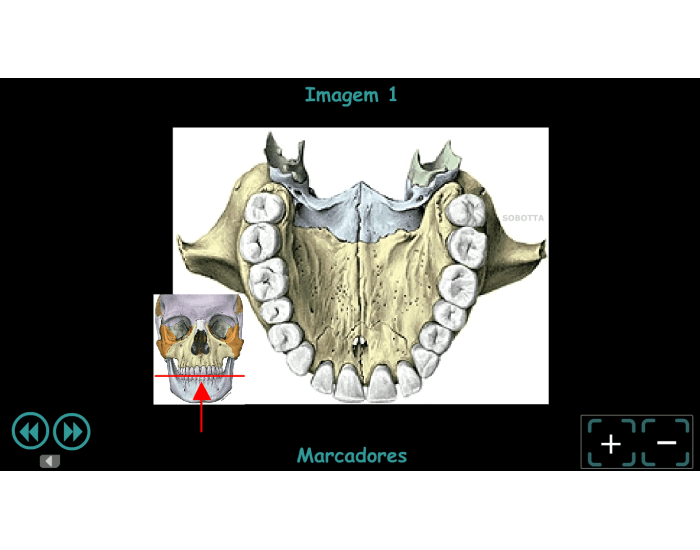 Anatomia da Base Interna do Crânio Quiz