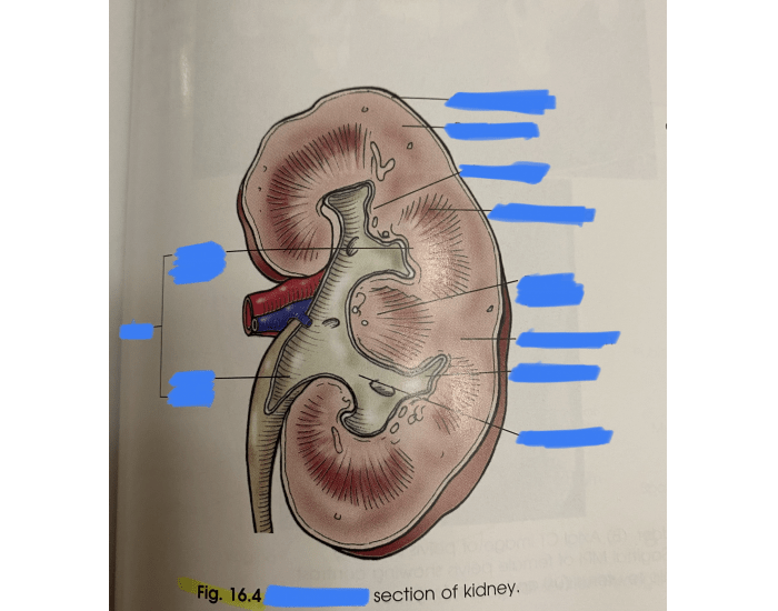 Midcornal Midcoronal section of kidney Quiz