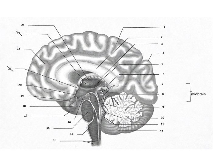 Brain Anatomy model simple Quiz