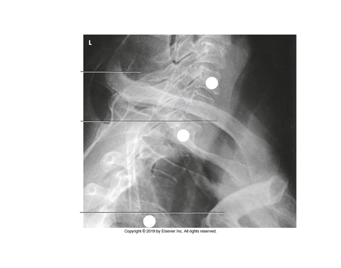 Twining Method Radiography swimmers lateral twining method Quiz