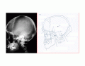 Skull & Facial Xray Lateral