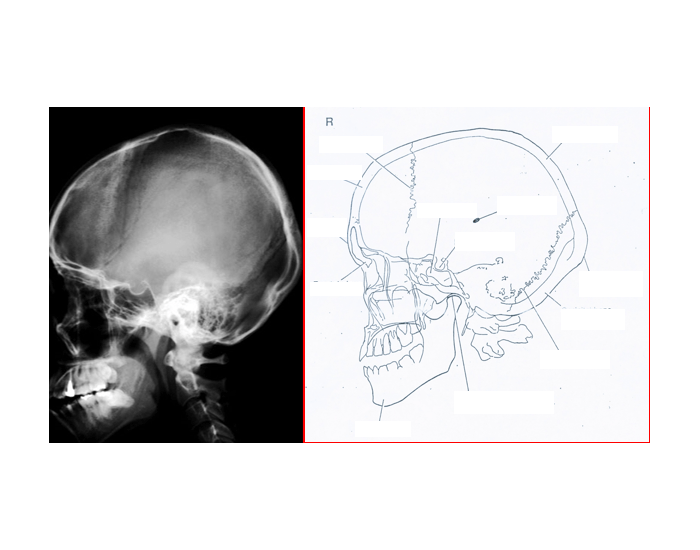 Lateral Skull X Ray Anatomy Film X Ray Skull Image & Photo (Free
