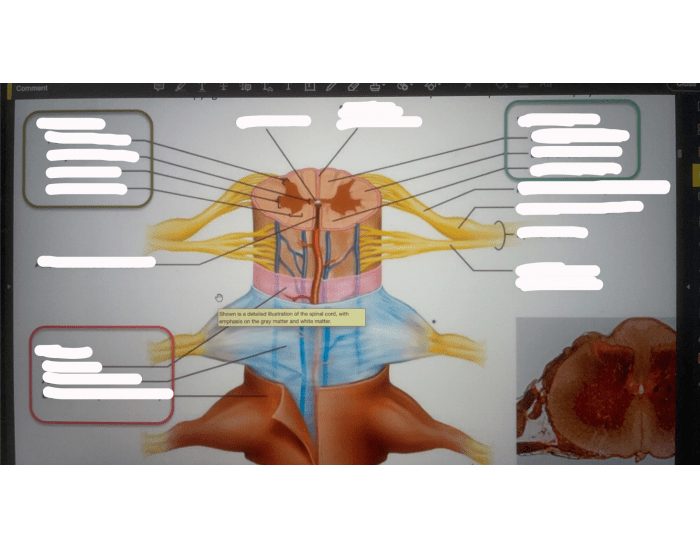 sectional Anatomy 2 Quiz Biology Diagrams