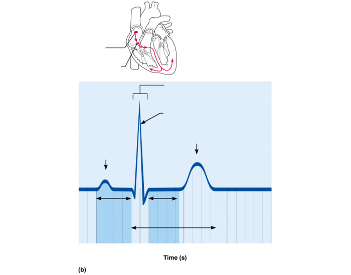electrocardiogram tracing Quiz
