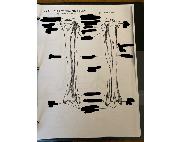 Tib-fib frontal/dorsal view Quiz
