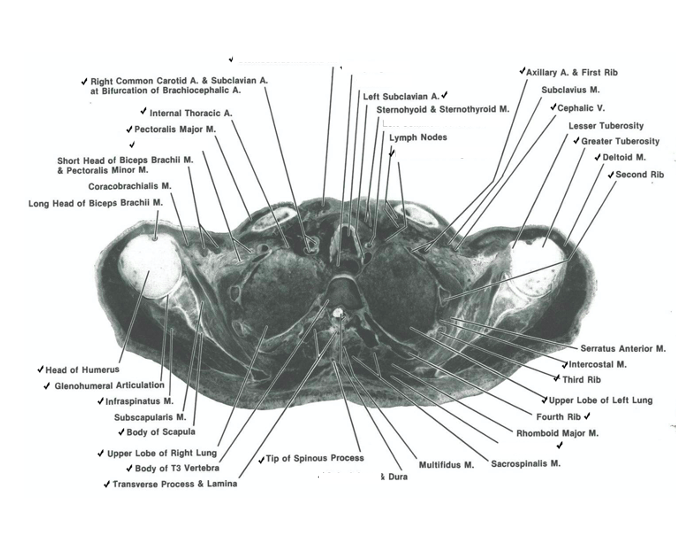 thorax cadaver 3 Quiz