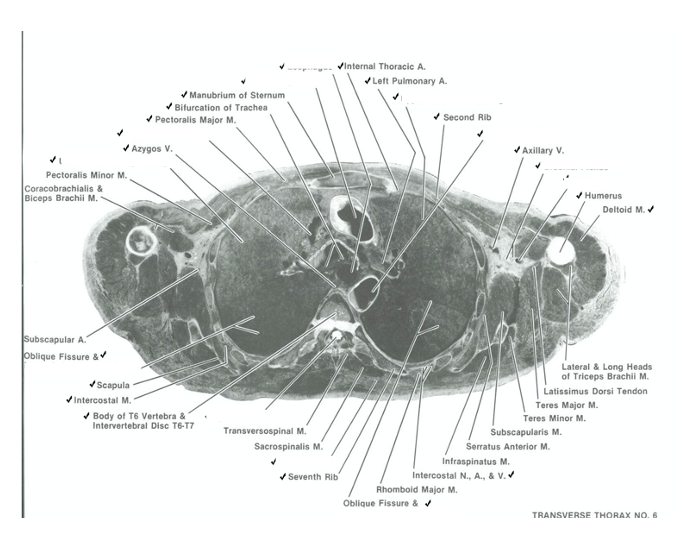 thorax cadaver 6 Quiz