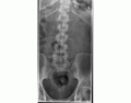 Lumbar Spine X-Ray Anatomy (TheX-RayDoctor Image)