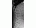 Lumbar Spine X-Ray Anatomy (Pinterest Image)