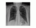 Chest X-Ray Anatomy (TheXRayDoctor Image)