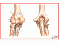 Elbow Osteology extension diagram