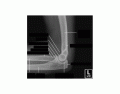 Lateral Elbow xray