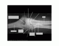 AP Elbow x ray