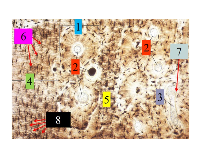 Bone Histology Labeled Printable Worksheet