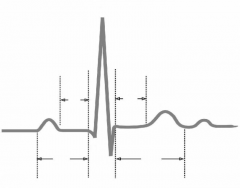 Cardiac Cycle Waves
