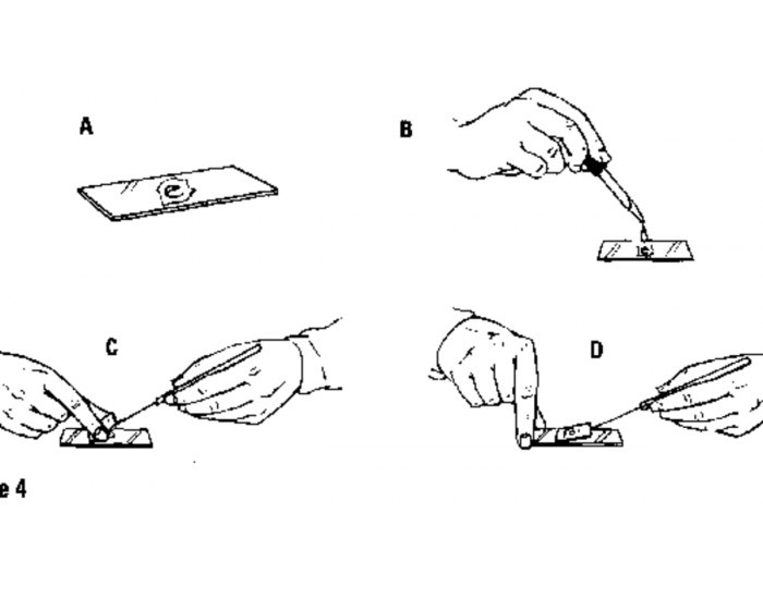 Smear Method Fecal Direct Smear Procedure Quiz