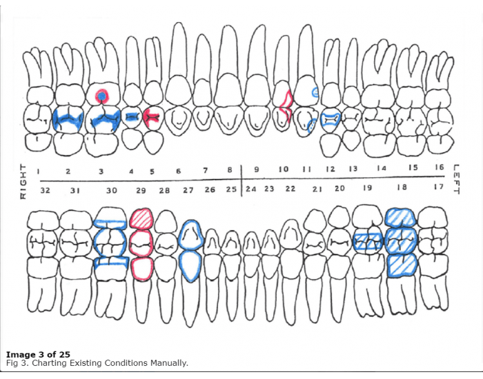 Dental Charting Quiz Dental charting quiz